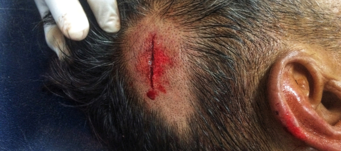 $300,000 Wrongful Death Settlement
